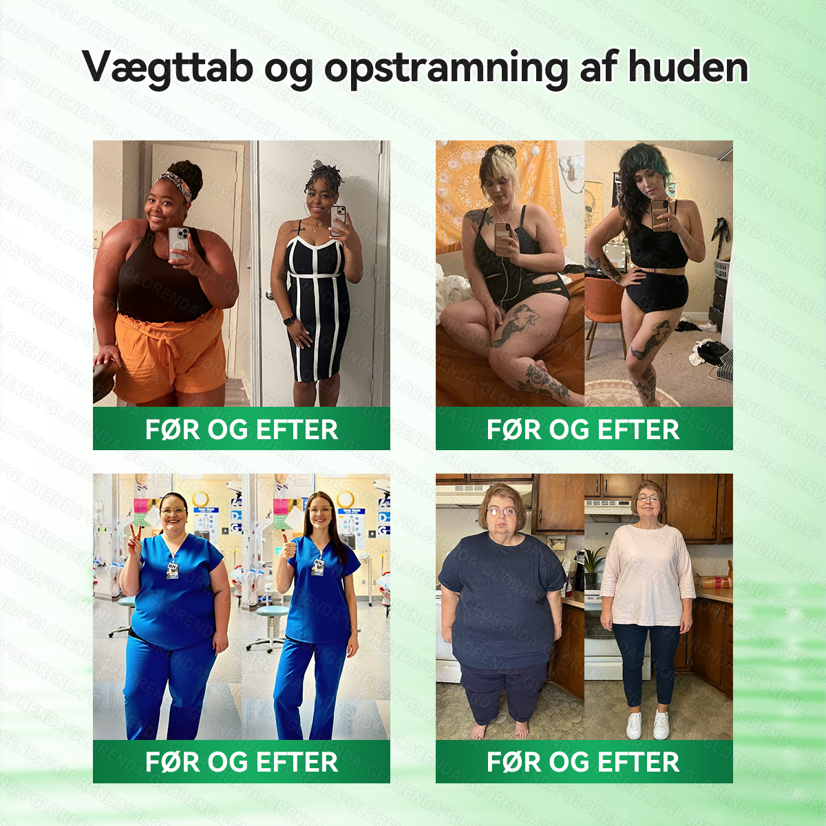 𝑶𝒇𝒇𝒊𝒄𝒊𝒆𝒍 𝑩𝒖𝒕𝒊𝒌 | 💊🌱𝐆𝐋𝐎𝑹𝑬𝑵𝐃𝗔® 𝑴𝒐𝒓𝒊𝒏𝒈𝗮 · 𝗕𝗲𝗿𝗯𝗲𝗿𝗶𝗻 × 𝑵𝐀𝐃⁺ 𝟏𝟎-𝐢-𝟏 𝗔𝗱𝘃𝗮𝗻𝗰𝗲𝗿𝗲𝘁 𝙉𝙖𝙣𝙤-𝙈𝙞𝙠𝙧𝙤𝙣𝙖̊𝙡 𝙋𝙡𝙖𝙨𝙩𝙚𝙧 🇩🇰 (Kun én gang om dagen – synlige forandringer på 7 dage)
